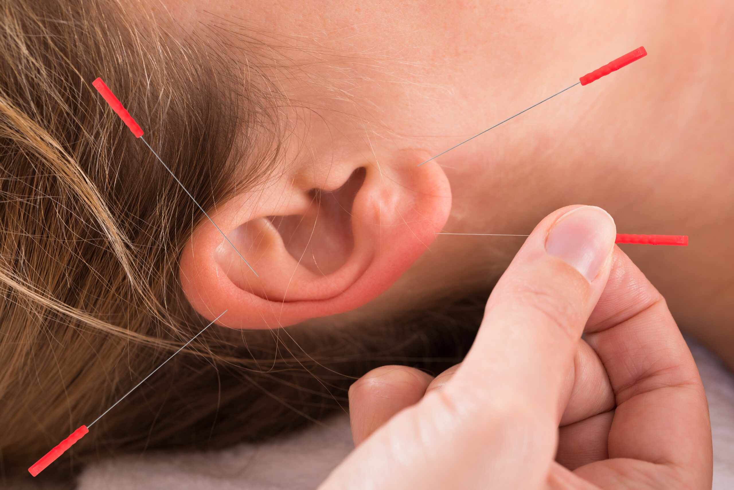 Closeup of hand performing acupuncture therapy on auricle at salon